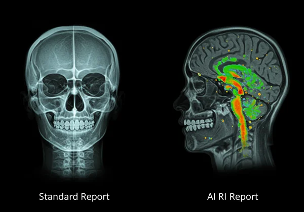 X-ray vs MRI showing basic vs detailed ADHD insights